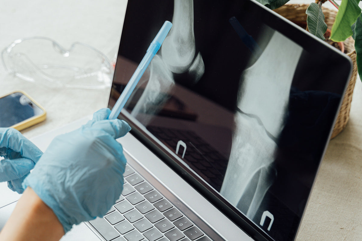 Glucosamine vs Fish Oil for Joint Health Vitamins and Supplements