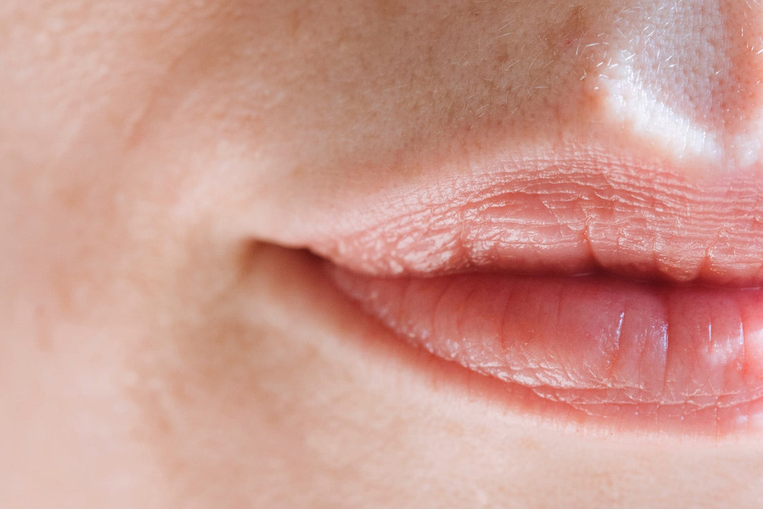 Benefits of Using Hyaluronic Acid for Lips