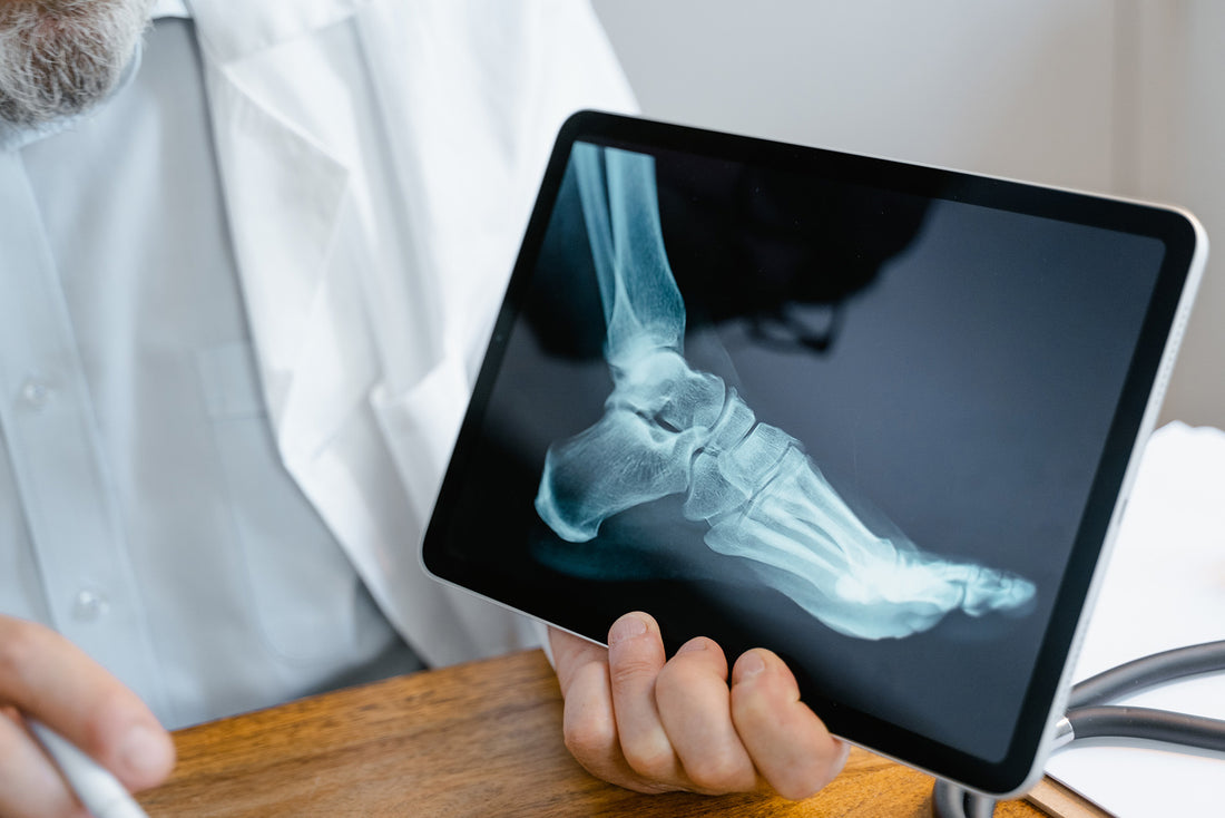 Calcium Carbonate and Bone Health