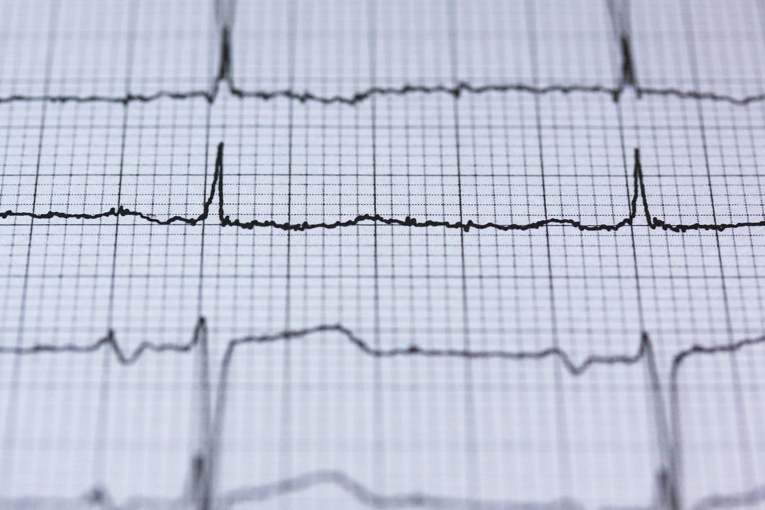 Benefits of D3 and K2 for Cardiovascular Health