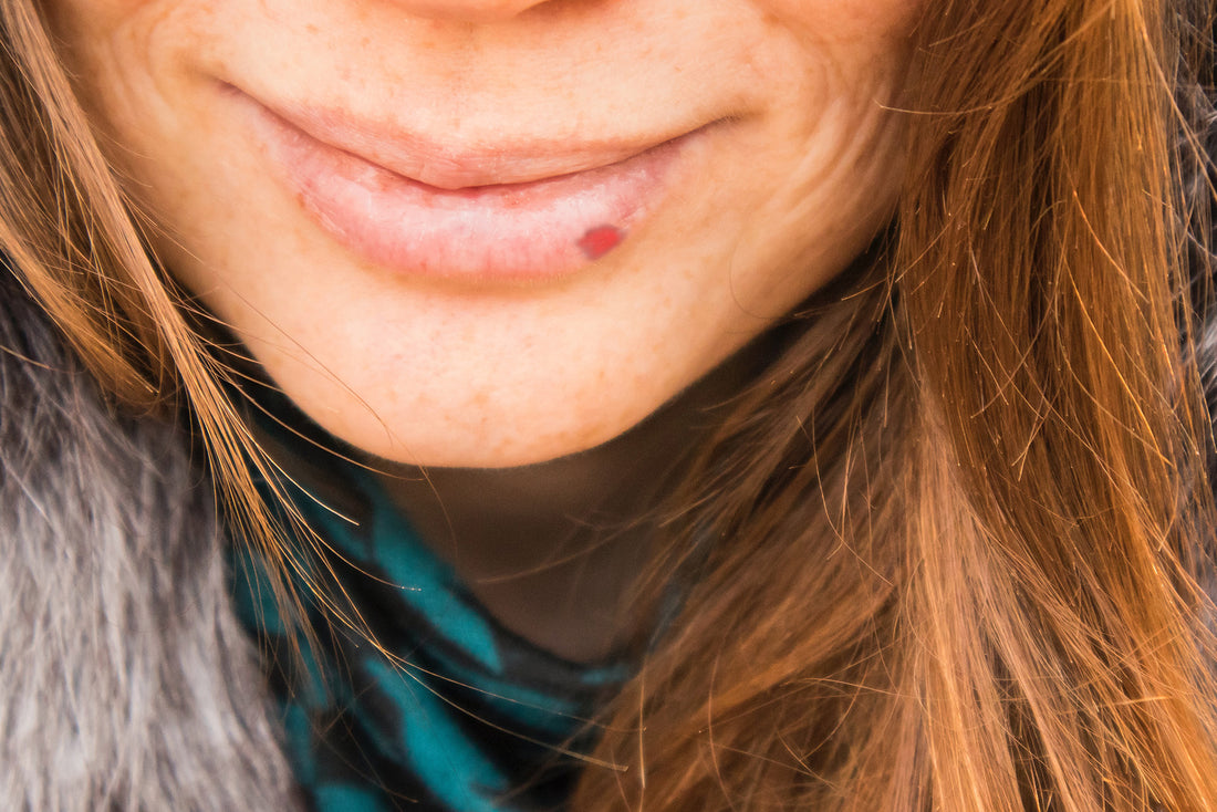 Echinacea and Cold Sores