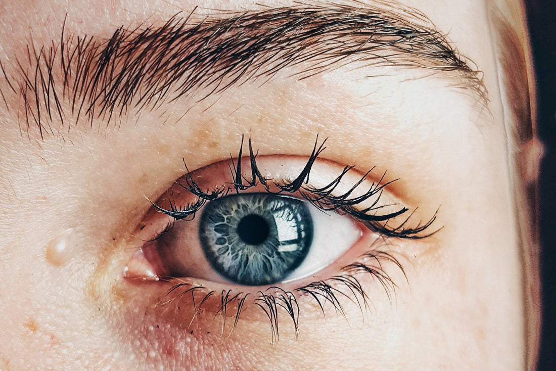 Lutein and Zeaxanthin for Eye Floaters