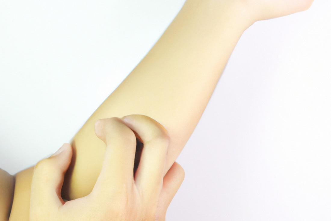 Lutein for Eczema: Exploring the Potential Benefits