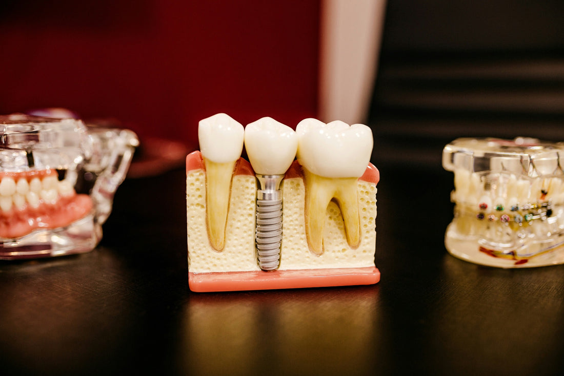 Natural Remedies for tooth infection