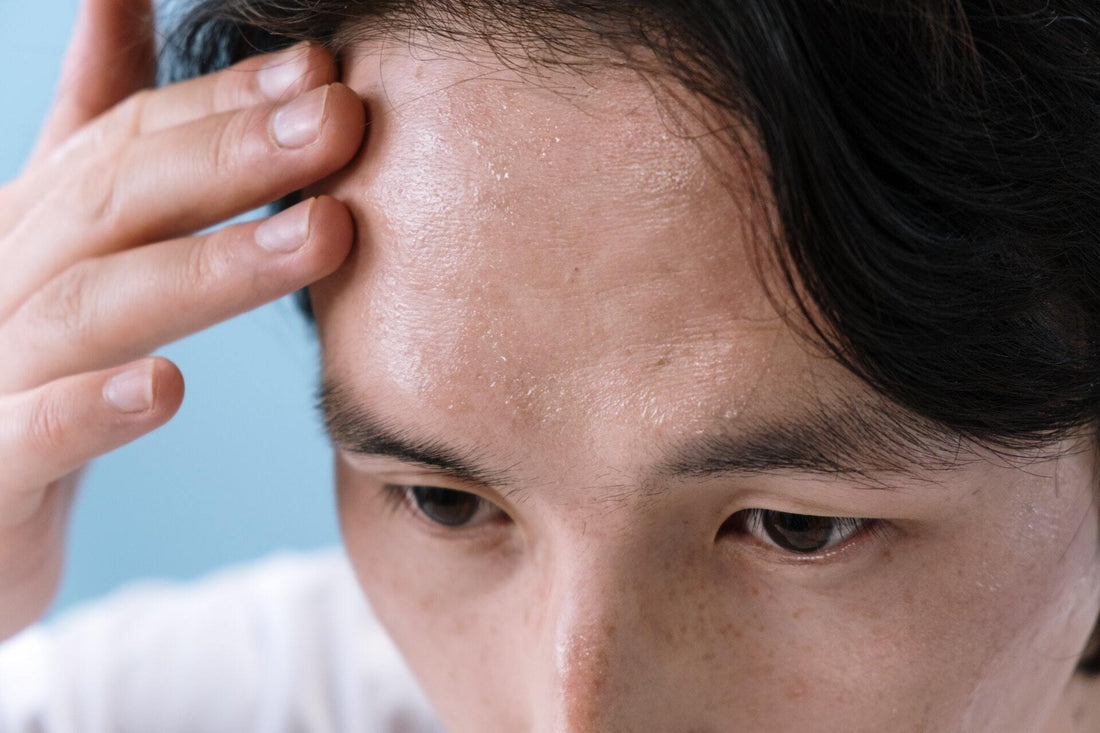 Q10 for Headaches