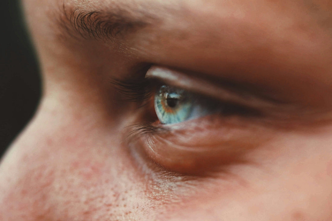 Natural Remedies to treat skin allergies
